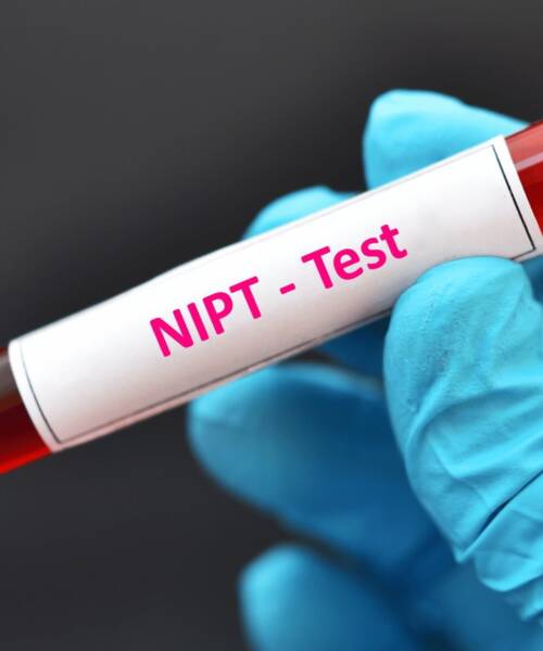 NIPT – Неінвазивний пренатальний тест Рекомендовано всім вагітним