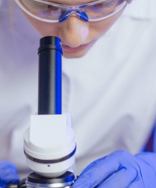BAT basophil activation test